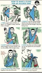 How To Make A Sling For An Injured Arm